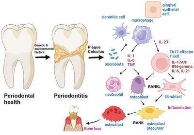Cytokines in <mark class="highlighted">gingivitis</mark> and periodontitis: from pathogenesis to therapeutic targets